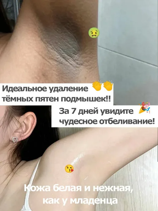 LYDIMOON Отбеливающее мыло с витамином С Интимные части, лицо，Руки, вариант, фото 5