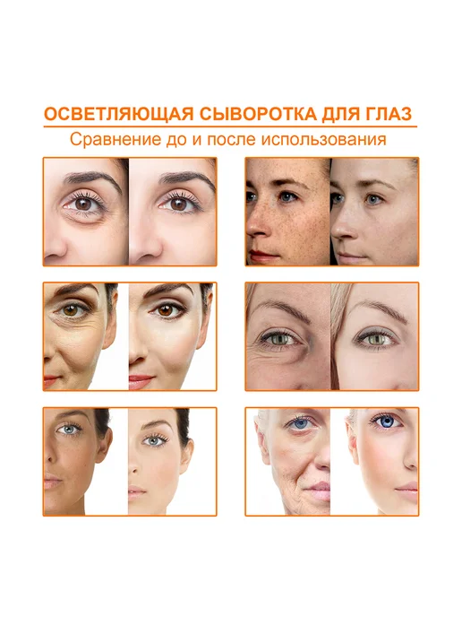 West&Month Эфирное масло уменьшает пигментацию против морщин, вариант, фото 5