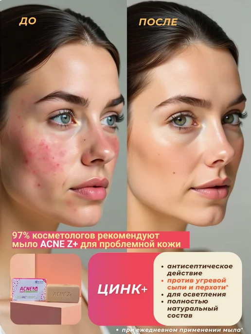 Аль Шахбаа Мыло от акне и прыщей с серой Z+ 1 шт, 1 шт, фото 2