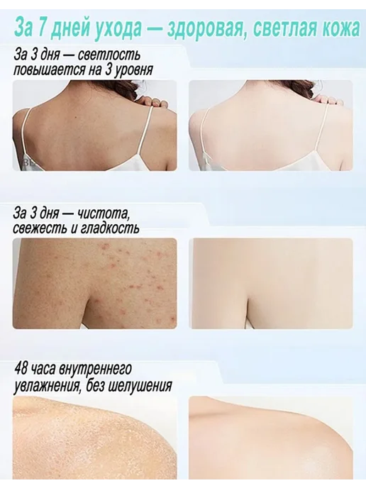 NOVALAB Гель для душа для ухода за кожей спины и тела, вариант, фото 4