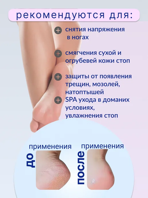 Силиконовые носочки для педикюра от трещин многоразовые, вариант, фото 2