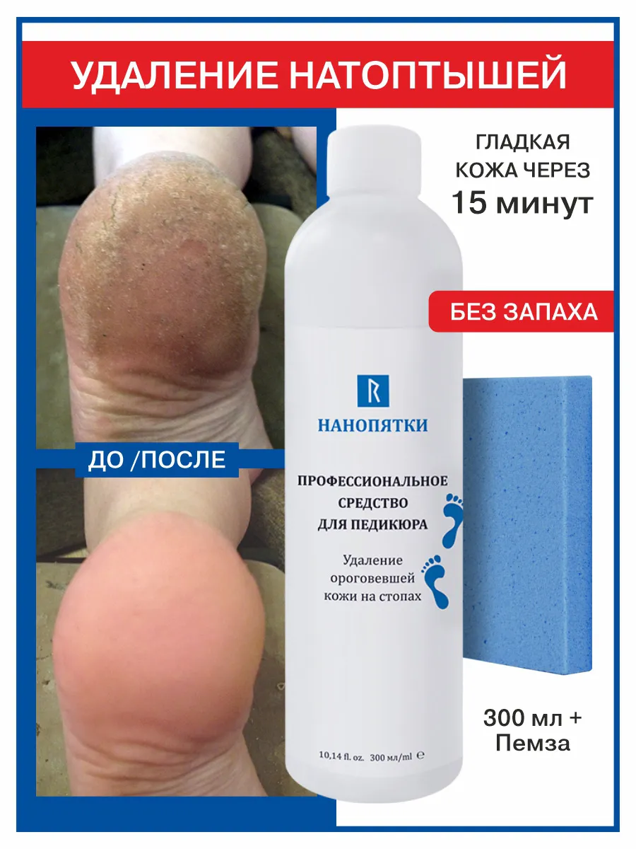 Средство для педикюра, 300 мл + пемза для гладких ровных пяток