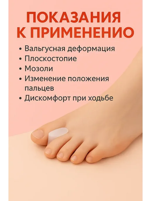 MadiMax Силиконовые разделители ортопедические, вариант, фото 2