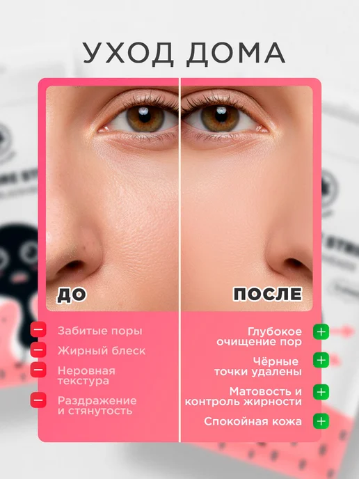 NSC Очищающие полоски для носа от черных точек пластырь 1уп*5шт, 5 шт, фото 4