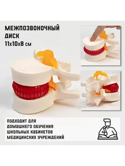 Paraplan Макет межпозвонкового диска 11x10x8 см для учебы
