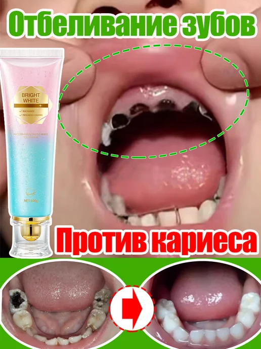 LYDIMOON Отбеливающая зубная паста, подходит для детей от 6 лет 100 г, 100 г