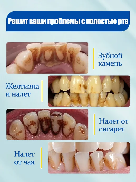 LYDIMOON Отбеливающая зубная паста, подходит для детей от 6 лет 100 г, 100 г, фото 3