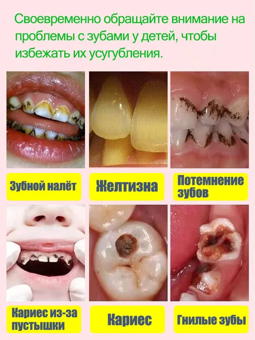 LYDIMOON Отбеливающая зубная паста, подходит для детей от 6 лет 100 г, 100 г, фото 4