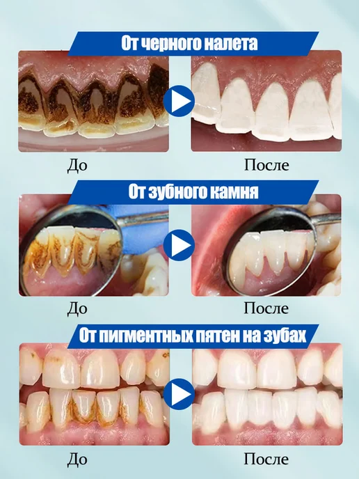 LYDIMOON Отбеливающая зубная паста, подходит для детей от 6 лет 100 г, 100 г, фото 5