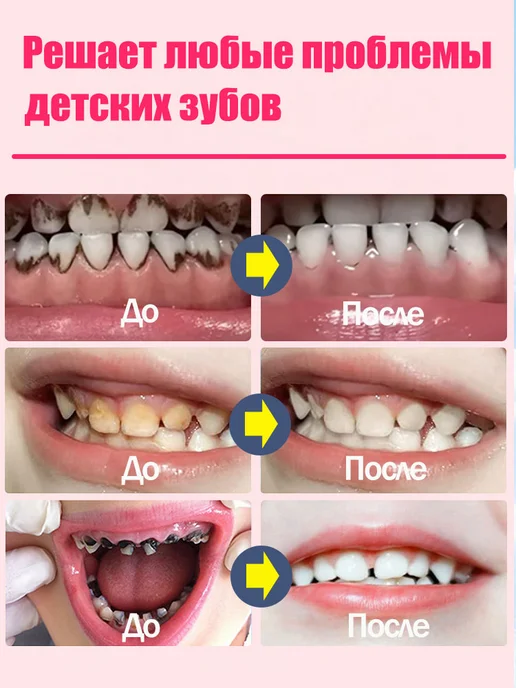 LYDIMOON Отбеливающая зубная паста, подходит для детей от 6 лет 100 г, 100 г, фото 6